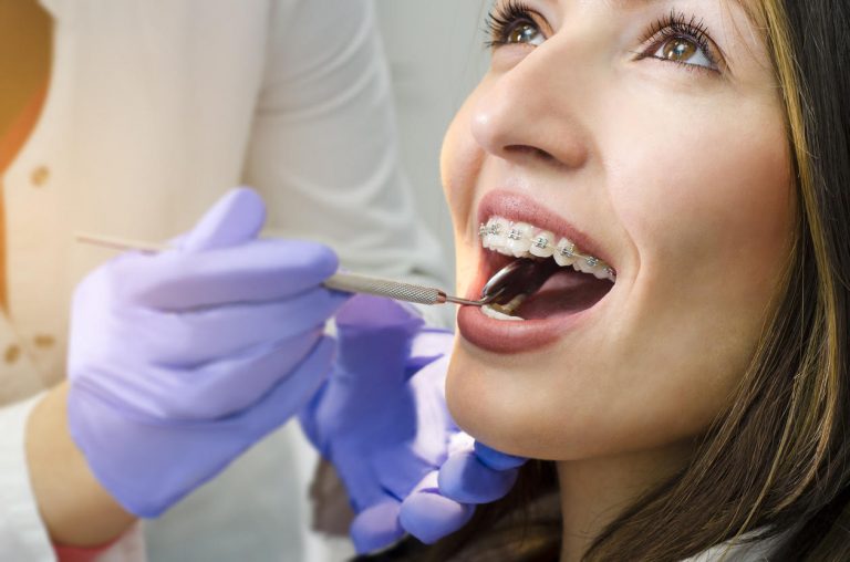 Orthodontie chez l’adulte : est-elle remboursée ?