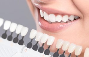 Blanchiment des dents : le danger des « bars à sourire »