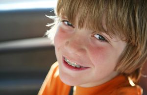 Orthodontie chez l’enfant : est-elle remboursée ?