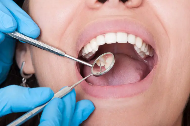 Caries : ce produit chimique dans l’eau potable peut favoriser leur apparition